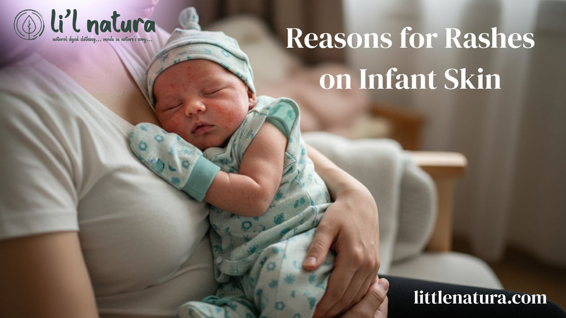 Reasons for Rashes on Infant Skin and How to Prevent Them Naturally